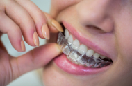 Исправления прикуса в клинике «Ваша стоматология»  - 