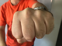 Избитому анапчанину отказали в возбуждении уголовного дела