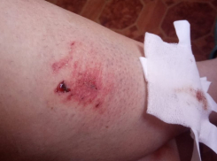«Анапа должна быть безопасным городом»: агрессивная бездомная собака покусала москвичку