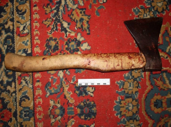 В городскую больницу Анапы поступил мужчина с ранами на голове и груди от топора 