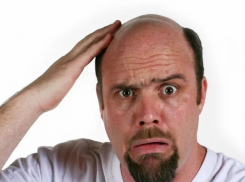 У лысых анапчан могут появиться волосы