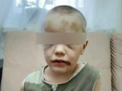 Восьмилетнего мальчика, угнавшего микроавтобус в Анапе, избивала и кусала мать