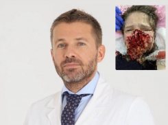 Уроженцу Анапы Алексею Дикареву отказали в желании спасти внешность девушке после нападения овчарок