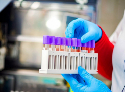 55 пациентов с коронавирусом умерли. Актуальная сводка на 17 июня