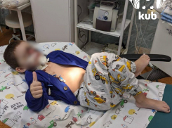 Микрохирург из Анапы впервые в России провел операцию по восстановлению лица ребенку и его уволили