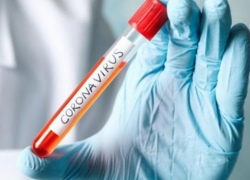 Число зараженных COVID-19 выросло на 90 человек. В Анапе на 12 сентября +1