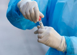 Число заражений коронавирусом в крае снизилось на 7,5%