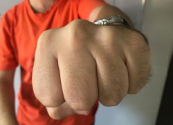 Избитому анапчанину отказали в возбуждении уголовного дела