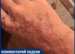 Анапский дерматолог Игорь Клименко рассказал, какую опасность таят временные тату