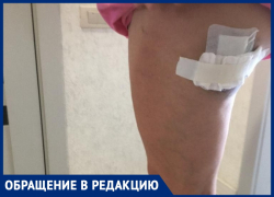 «Крики, швы на ногах и испуг»: на анапчанку напала стая собак