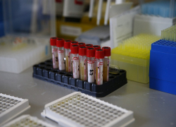 В Анапе за сутки 18 новых случаев COVID-19. Сводка на 20 ноября