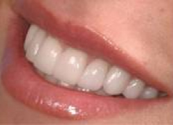 Хочешь иметь ослепительную улыбку? Заходи в справочник