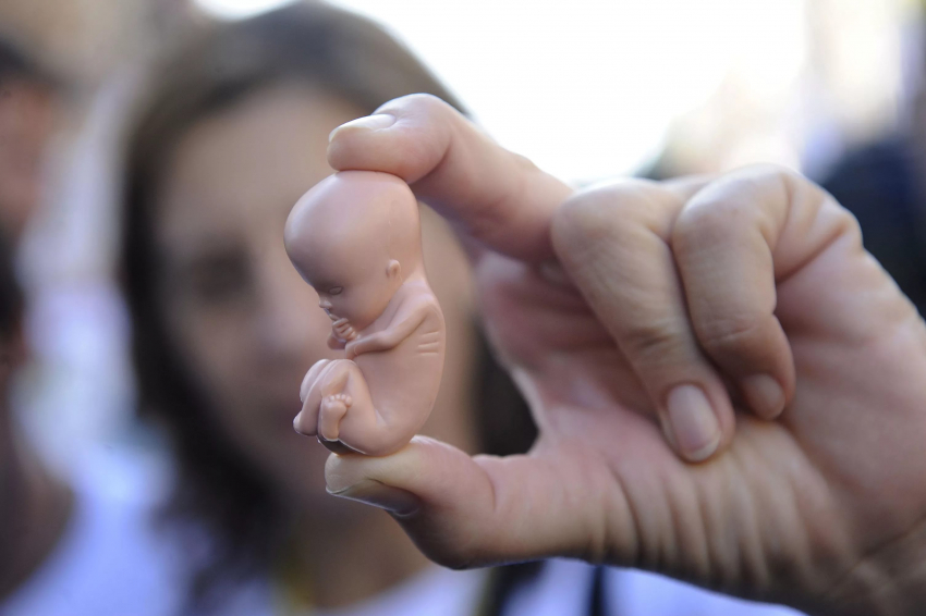 В России могут запретить делать аборты за счёт государства