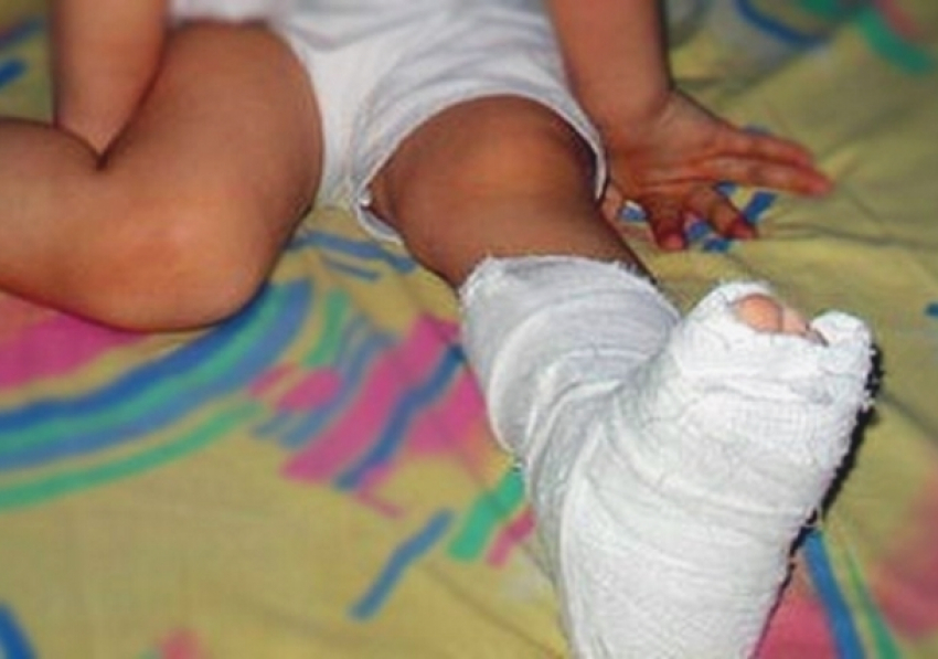 В Анапе по вине родителей под колеса автомобиля попал 5-летний малыш