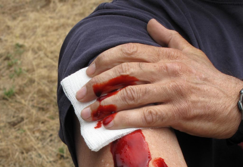В Анапе 39 человек «потеряли» 20 литров крови